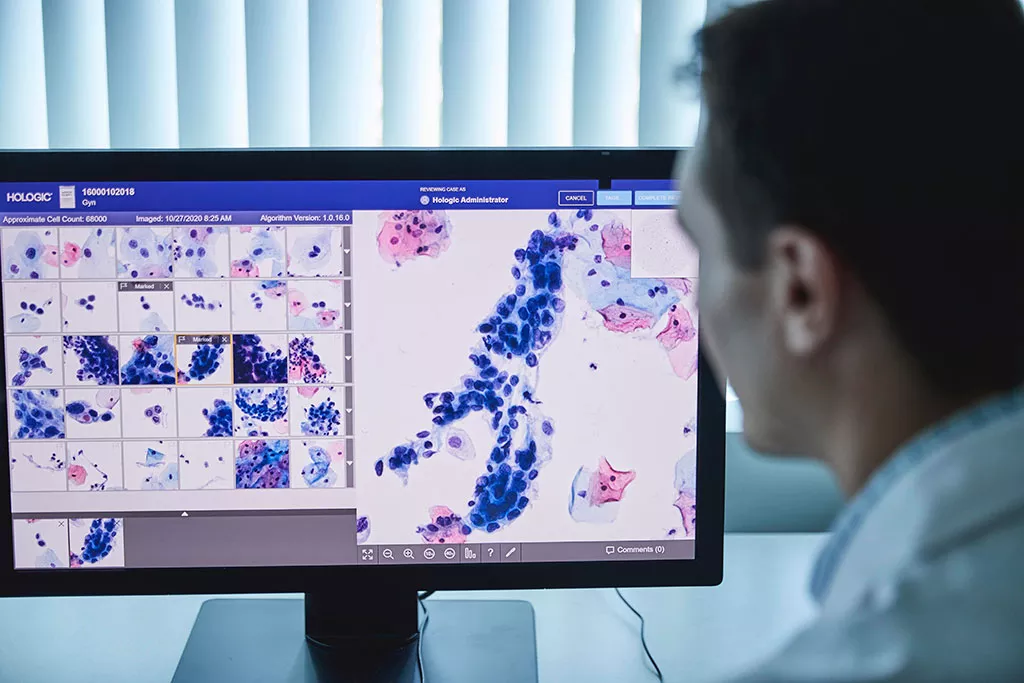 A lab worker is looking at cervical cells on the Genius Review Station monitor.